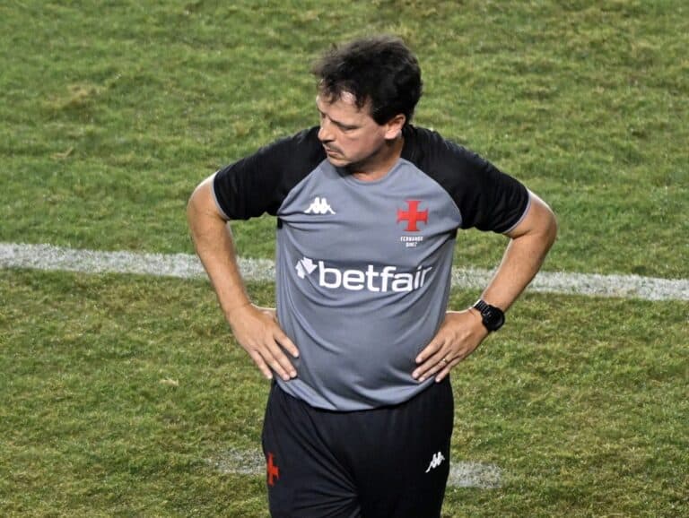 Texto alternativo: Técnico do Vasco com uniforme cinza e preto, mãos na cintura, em campo de futebol.
